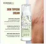 Eczemaron Anti Fungal Cream – Fast Relief from Eczema, Itching, Ringworm & Skin Infections – 30gm
