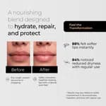 Intense Protection 5 In 1 Lip Balm | Brightens Dark Lips & Evens Lip Tone- 10gm