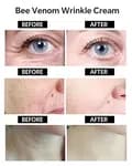 Premium Bee Venom Anti-Wrinkle & Firming Cream – Advanced Anti-Aging Therapy