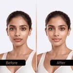 Intense Protection 5 In 1 Lip Balm | Brightens Dark Lips & Evens Lip Tone- 10gm