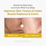 ​Medicube Kojic Acid Turmeric Night Wrapping Mask (75ml) – Brightening Overnight Face Mask for Dullness, Dark Spots & Glowing Skin