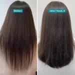 Pilgrim Hair Fall Control Shampoo with Redensyl & Anagain 200ml
