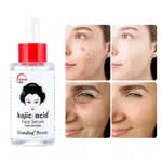 Kojic Acid & Niacinamide Ultra-Whitening Face Serum – Advanced Dark Spot Corrector & Anti-Wrinkle Essence