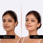 Instacare 20% Vitamin C Serum for Glowing Skin|Brightens Dull Skin, Evens Tone|For Men and Women - 30ml