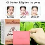 Collagen Acne Soap 701 | Pimple Removal & Oil Control | Skin Whitening & Acne Scar Treatment Face Soap
