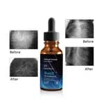 Bunee Hair Growth Anti Loss Thinning Serum MINOXIDIL 5% BIOTIN Treatment 60ml- Original Certified Product