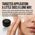 Arche Pearl Night Cream For Acne, Freckles, Melasma, Dark Spots, Pigmentation (Made In Thailand) 15g