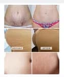 Fruit Of The Wokali Maternity Stretch Marks Cream (130 ml)