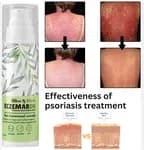 Eczemaron Anti Fungal Cream – Fast Relief from Eczema, Itching, Ringworm & Skin Infections – 30gm