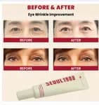 Ksecret Seoul 1988 Eye Cream Retinal Liposome 4% + Fermented Bean (30ml) for Wrinkle Care & Anti-Aging