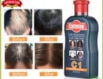 Hair Thick C1 Anti-Hair Loss Shampoo (100ml) – With Hair Growth Serum For Regrowth